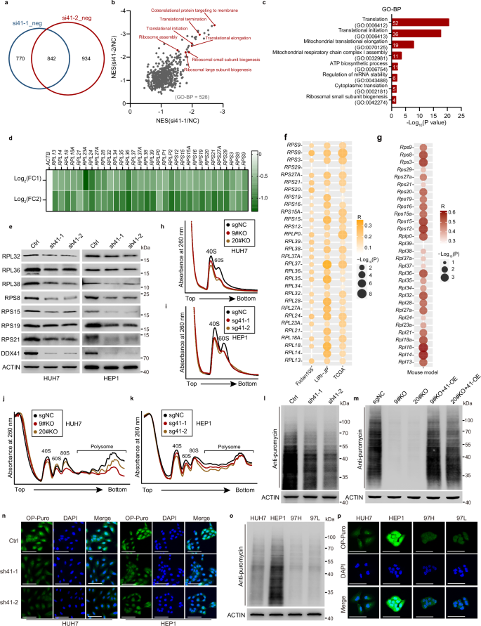 Fig. 3: DDX41 promotes ribosome biogenesis and protein synthesis by increasing RPL/RPS expression in liver cancer cells.