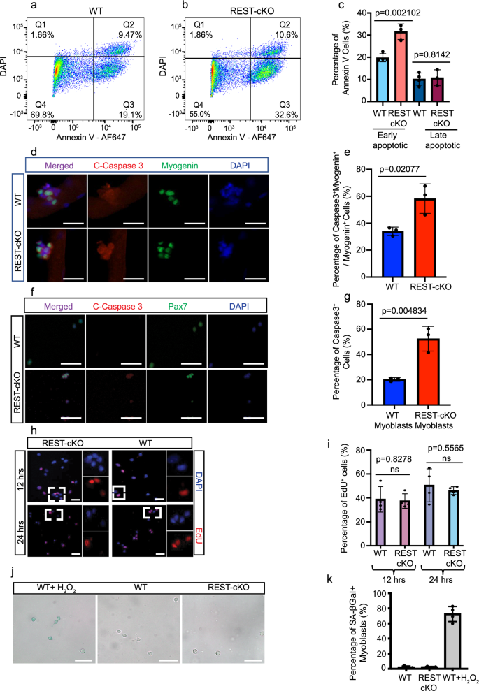 Fig. 6: Deregulation of MuSC gene expression patterns upon REST deletion leads to apoptosis of myogenic progenitor cells in adult mice.