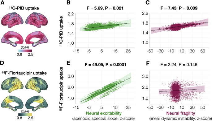 Fig. 3: Diverse associations between neural excitability and neural fragility with Aβ and tau accumulations in AD.