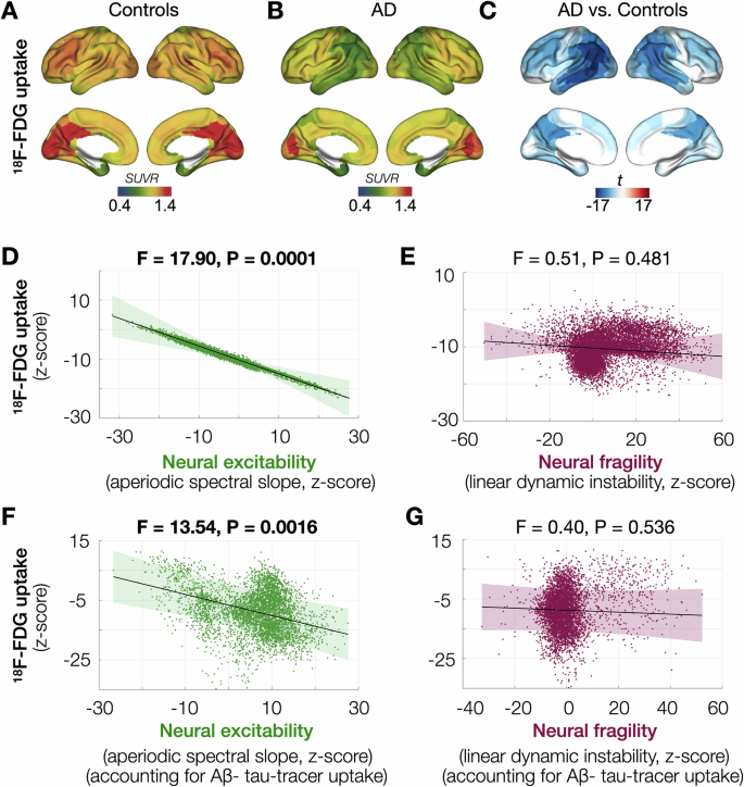 Fig. 4: Neural excitability and neural fragility associations with hypometabolism.