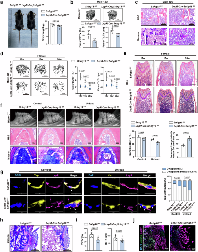 Fig. 5: Snhg18 knockout in LepR+ cells impairs bone homeostasis and Yap localization.