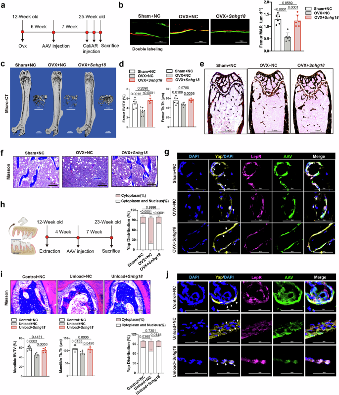 Fig. 7: Snhg18 delivery mitigates bone loss in OVX- and disuse-induced osteoporosis.