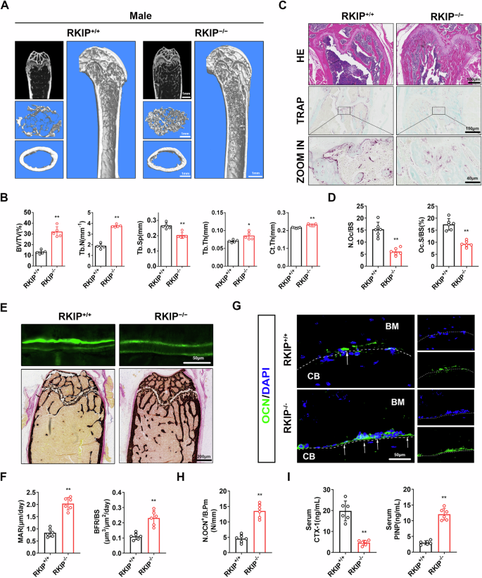 Fig. 1: Global knockout of RKIP inhibits bone resorption and promotes bone formation.