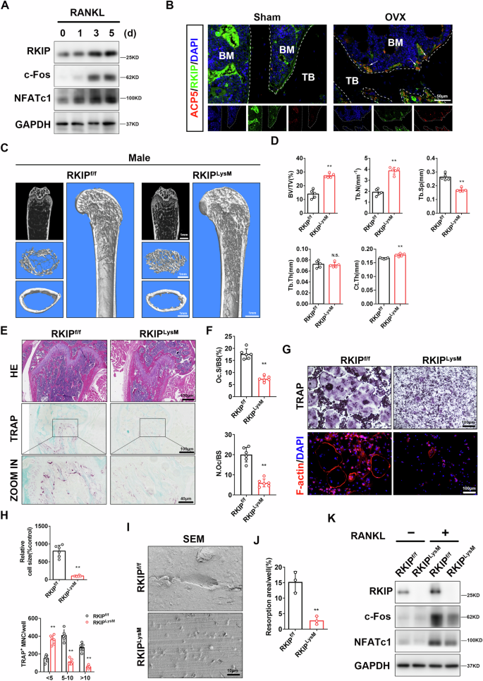 Fig. 2: Conditional knockout of RKIP in macrophages impedes osteoclastogenesis in vivo and in vitro.