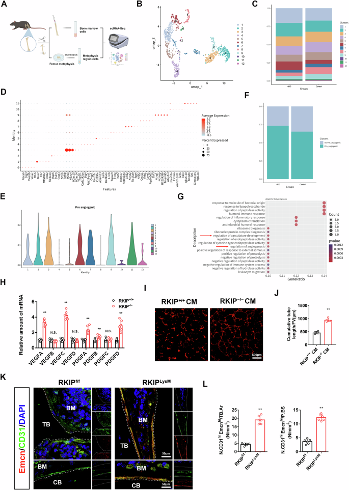 Fig. 4: RKIP regulates macrophage differentiation fate and influences H-type vessel formation.