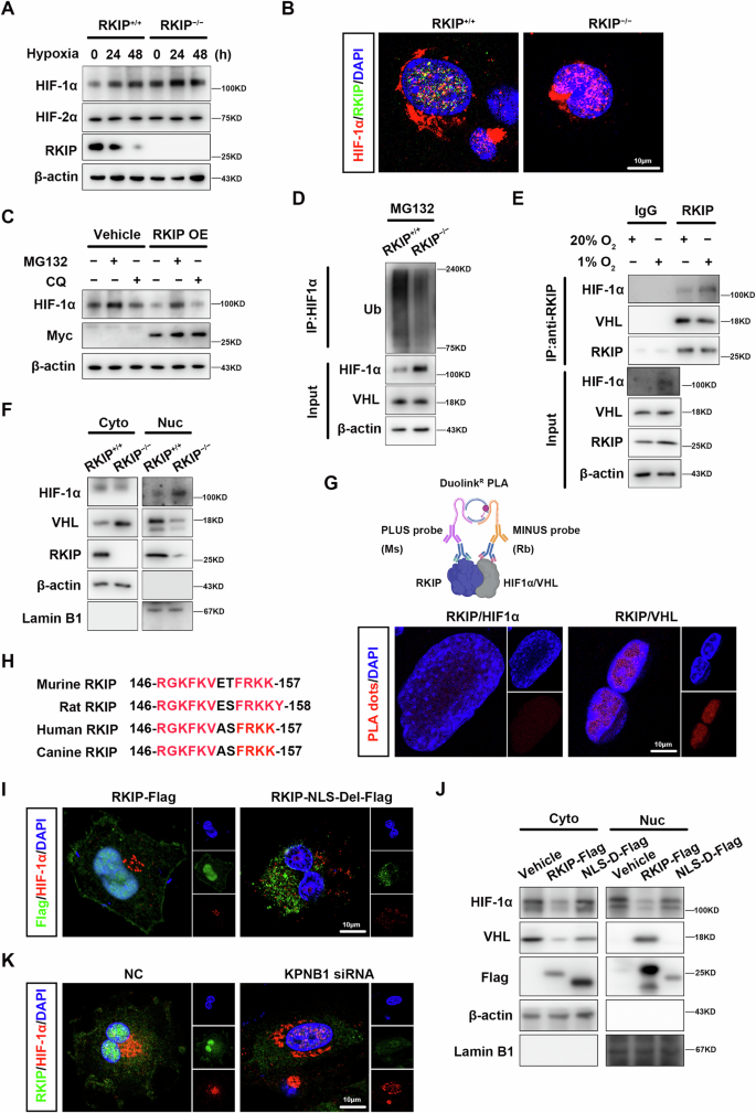 Fig. 5: Intranuclear RKIP modulates angiogenesis by regulating the protein stability of HIF-1α in macrophages.