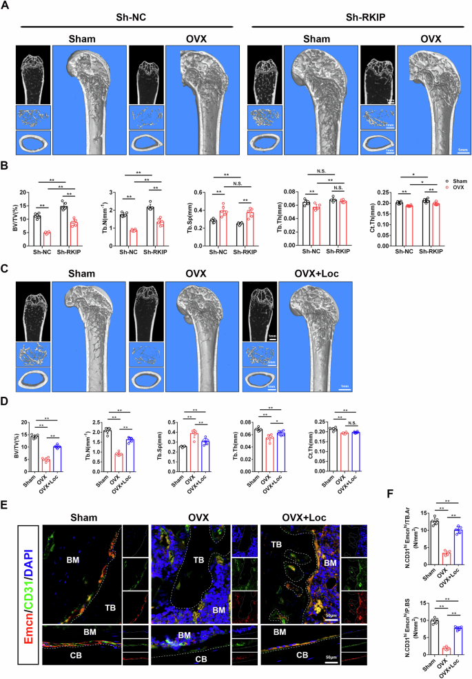 Fig. 6: Knockdown of RKIP and RKIP inhibitor prevent OVX-induced bone loss.