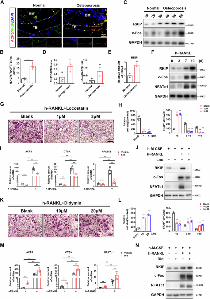 Fig. 7: RKIP regulates osteoclast differentiation in the human.