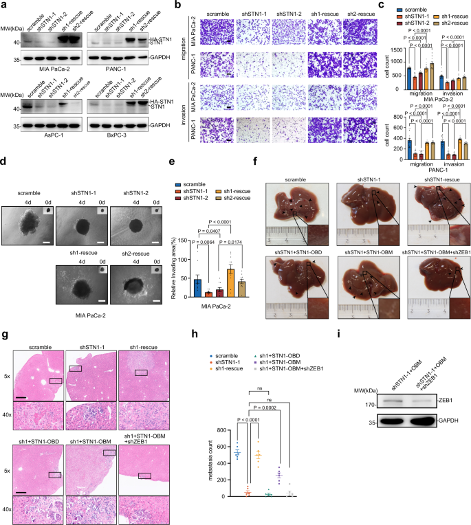 Fig. 2: STN1 facilitates PDAC progression through promotion of metastasis.