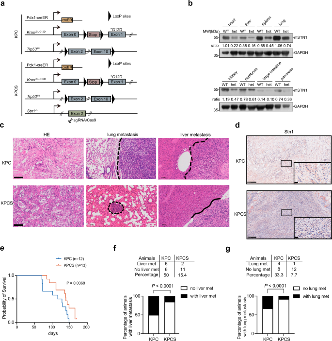 Fig. 3: Decrease of STN1 in KPC mice restrains PDAC metastasis.