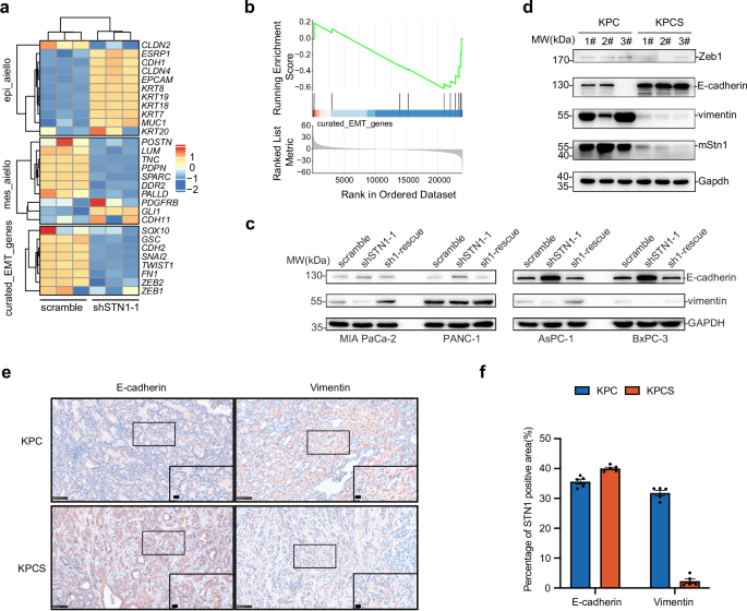 Fig. 5: STN1 promotes PDAC metastasis by facilitating the process of EMT.
