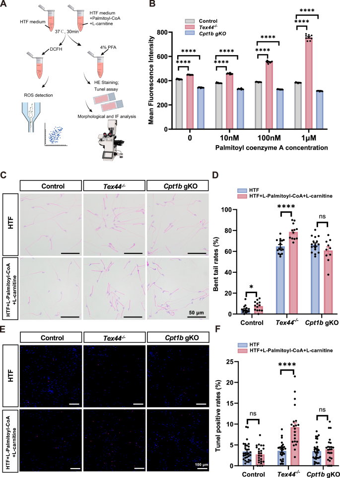 The TEX44-CPT1B axis regulates mitochondrial sheath assembly and fatty acid  oxidation in sperm