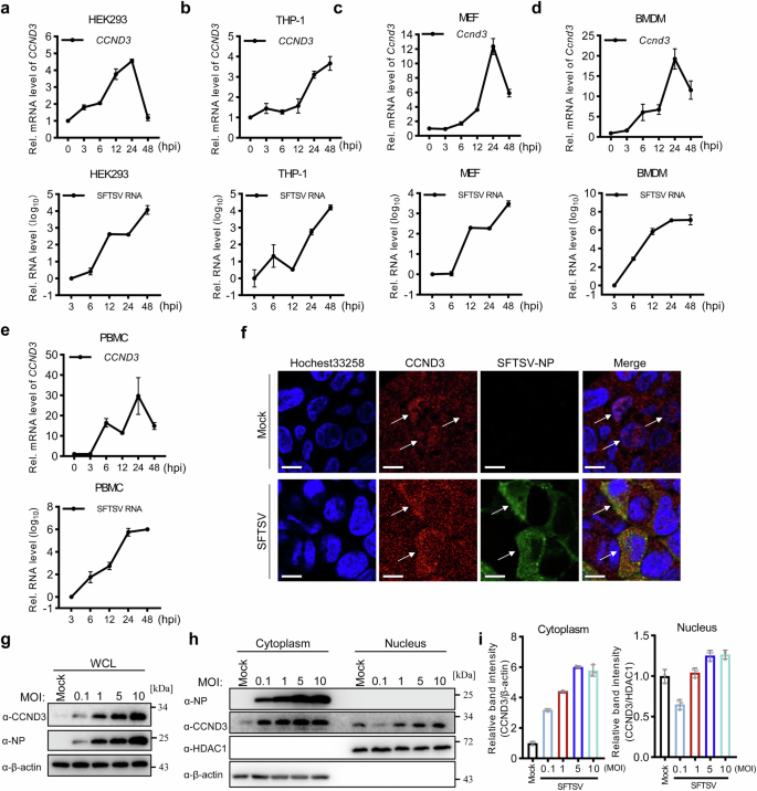 Fig. 2: SFTSV infection leads to CCND3 upregulation and cytoplasmic accumulation.
