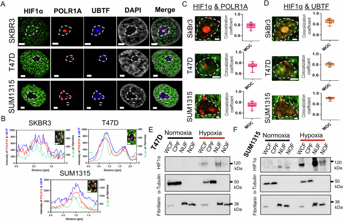 Fig. 4: HIF1α localizes to the nucleolus.
