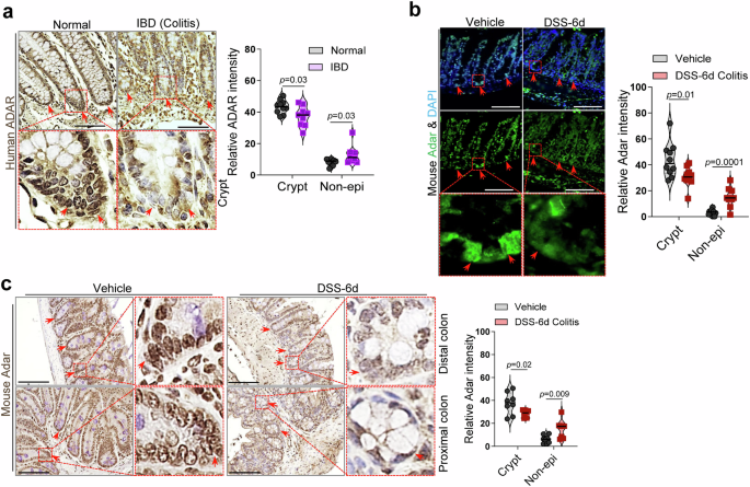 Fig. 2: The expression of ADAR is specifically decreased in the gut epithelium of IBD patients and mice.