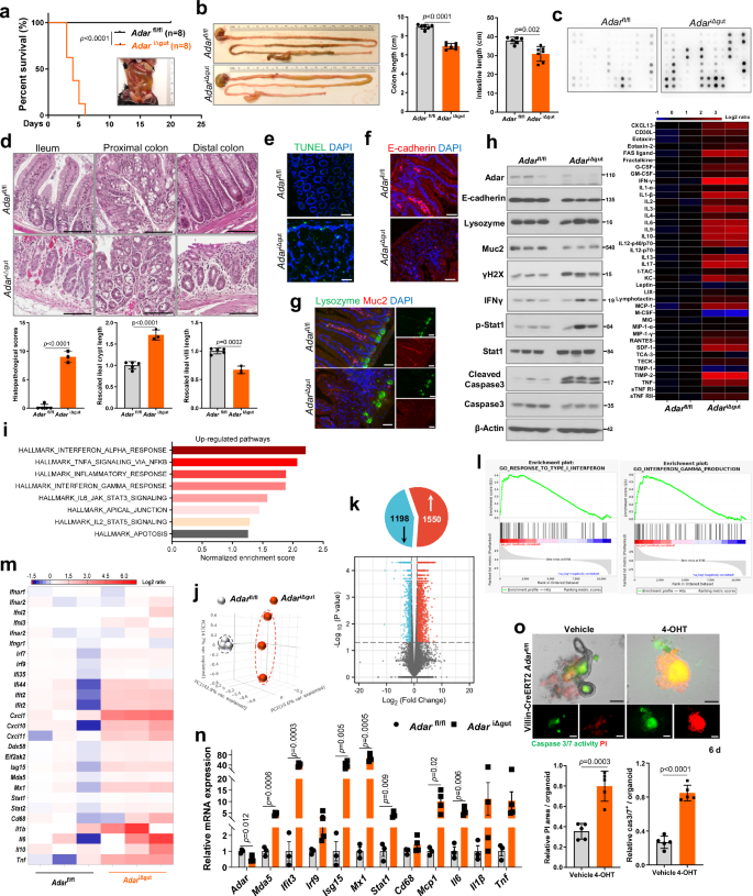 Fig. 3: Intestinal epithelial- or stem cell-specific ablation of ADAR triggers spontaneous bowel inflammation and compromises intestinal organoid growth.