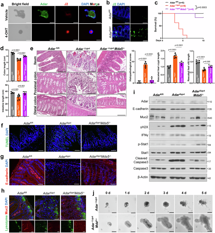 Fig. 5: MDA5-mediated dsRNA sensing is required for intestinal Adar deficiency-induced bowel inflammation and organoid death.