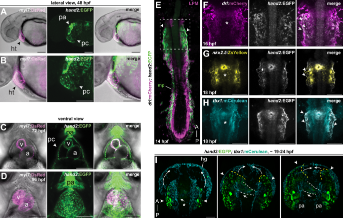 Fig. 1: The pericardium forms continuous with the mesothelium-forming LPM.