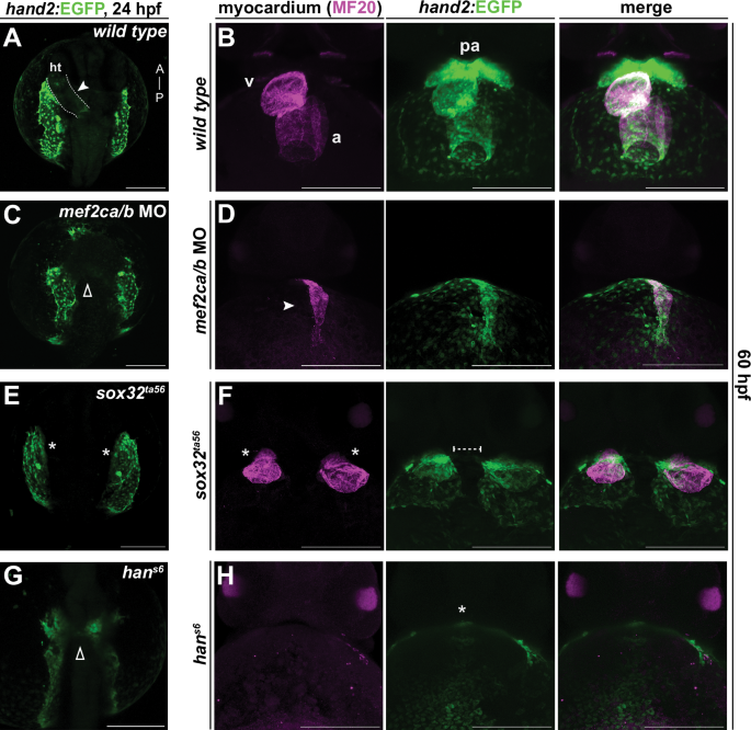 Fig. 5: The pericardium forms despite developmental insults to heart formation.
