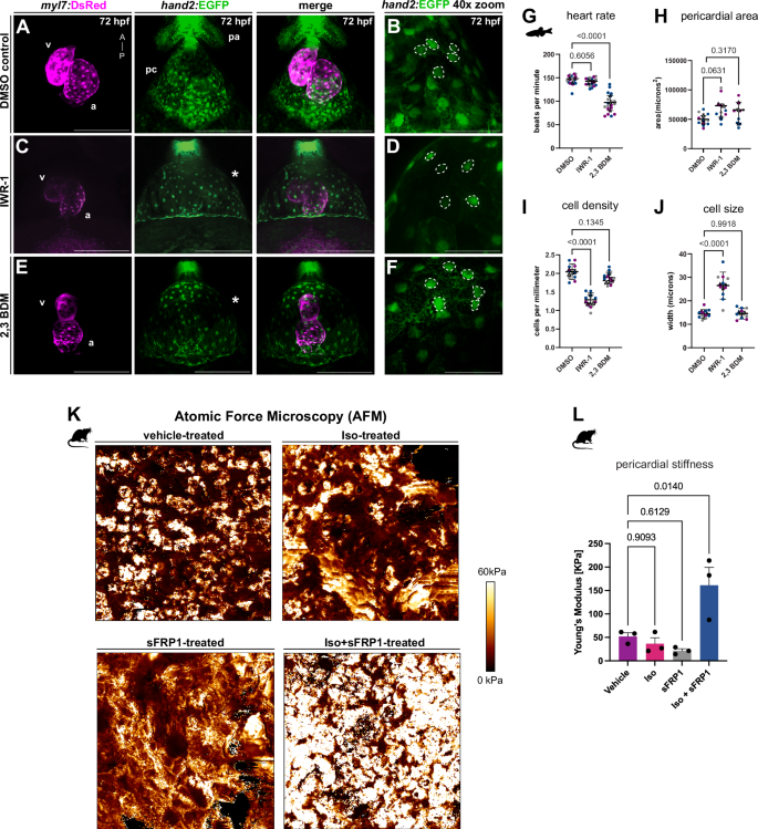 Fig. 7: Inhibition of Wnt/β-catenin alters pericardial morphology and stiffness.