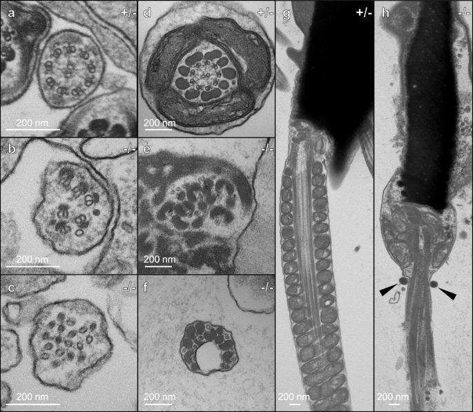 Fig. 3: Ultrastructural defects in Cfap91 KO spermatozoa.