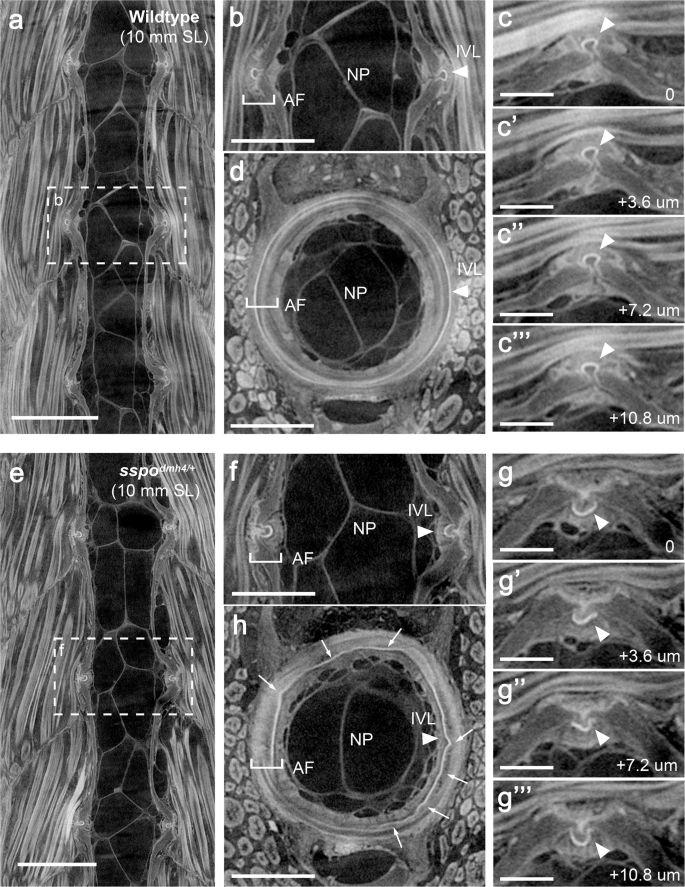 Fig. 2: Scoliotic fish exhibit intervertebral ligament deformations.