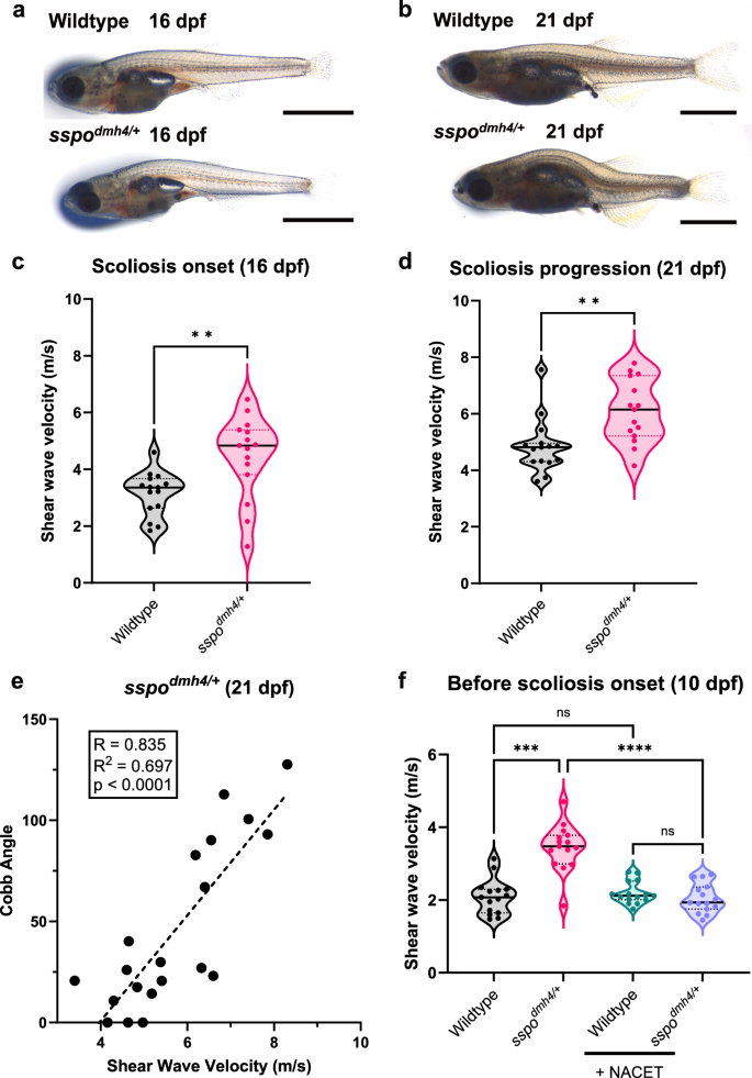 Fig. 5: Elevated spine stiffness is observed prior to scoliosis onset, positively correlates with curve severity, and is fully suppressed by antioxidant therapy.
