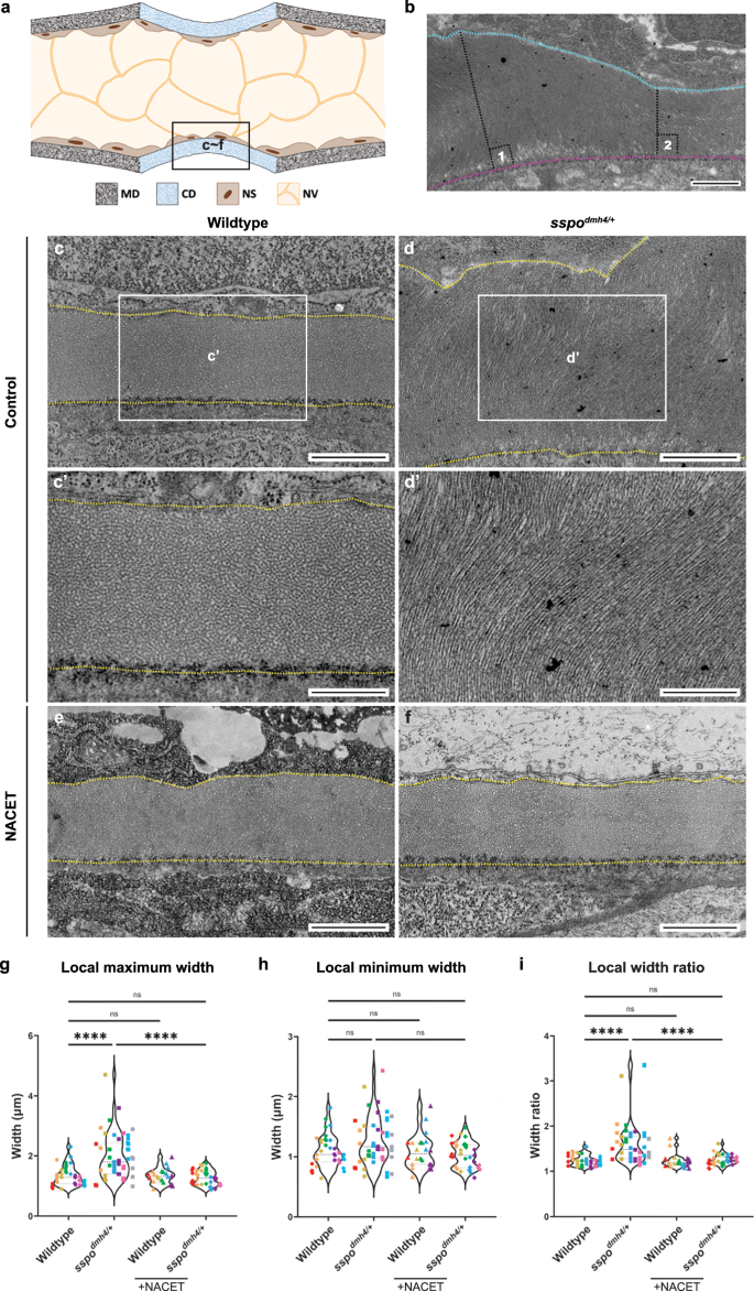 Fig. 6: Oxidative stress-induced ECM matrix defects precede scoliosis onset.