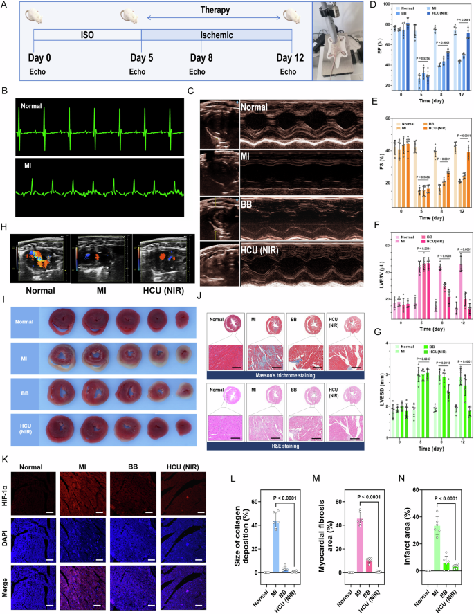 Fig. 6: In vivo therapeutic efficacy of photosynthetic system in myocardial ischemia mice.