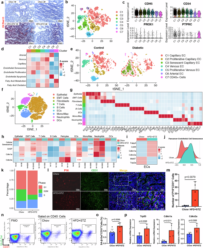 Fig. 3: Diabetes reshapes the cancer-associated endothelial niche by accelerating senescence.
