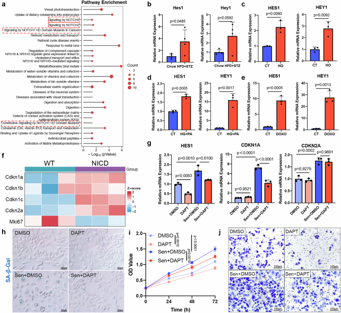 Fig. 5: Notch signaling is activated in senescent endothelial cells.