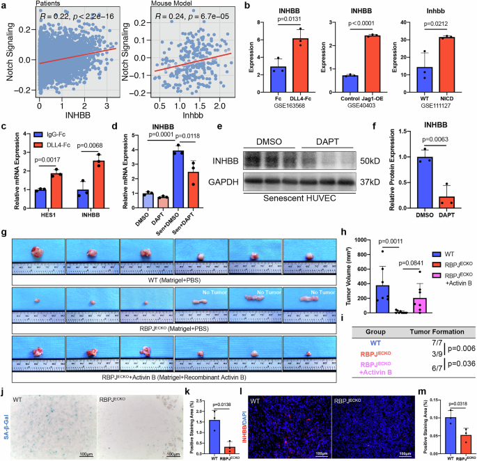 Fig. 7: Notch signaling regulates the expression of INHBB.