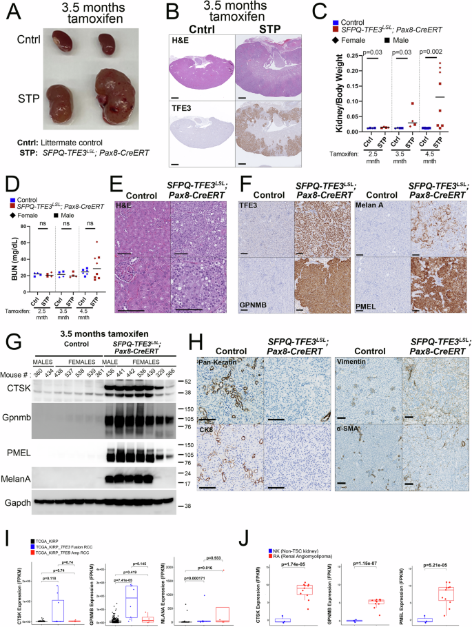 Fig. 2: Conditional post-natal, doxycycline-mediated induction of SFPQ-TFE3 in Pax8 Cre-ERT mice induces renal tumor development.