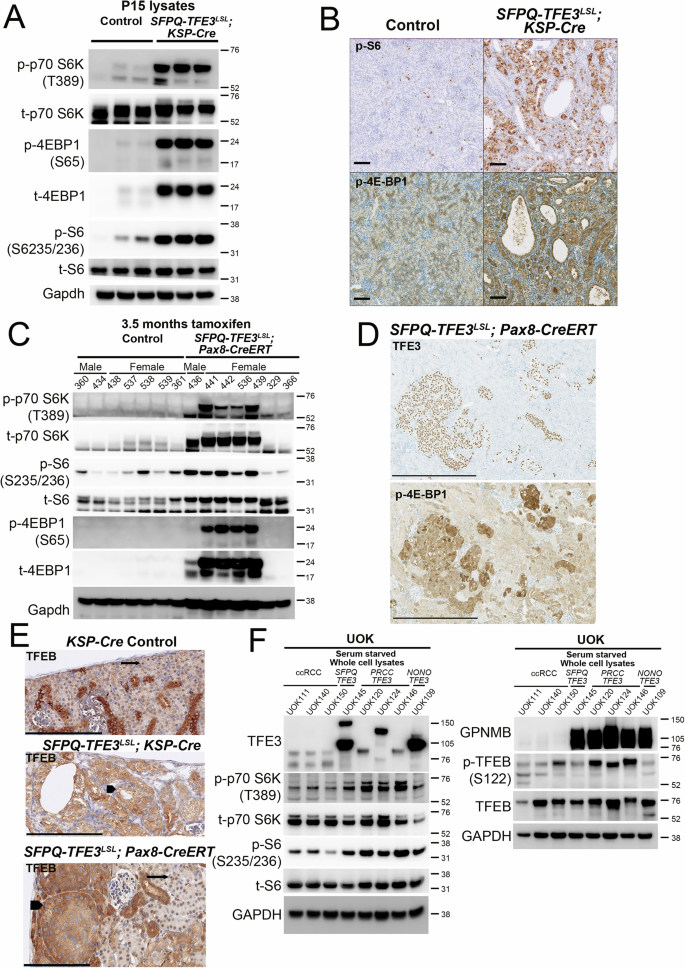 Fig. 3: mTORC1 signaling is activated in murine and human models of SFPQ-TFE3 fusion-RCC.