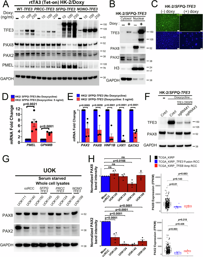 Fig. 6: Induction of SFPQ-TFE3 expression in human renal tubular epithelial cells results in lineage plasticity with silencing of nephric lineage factors, PAX8 and PAX2.