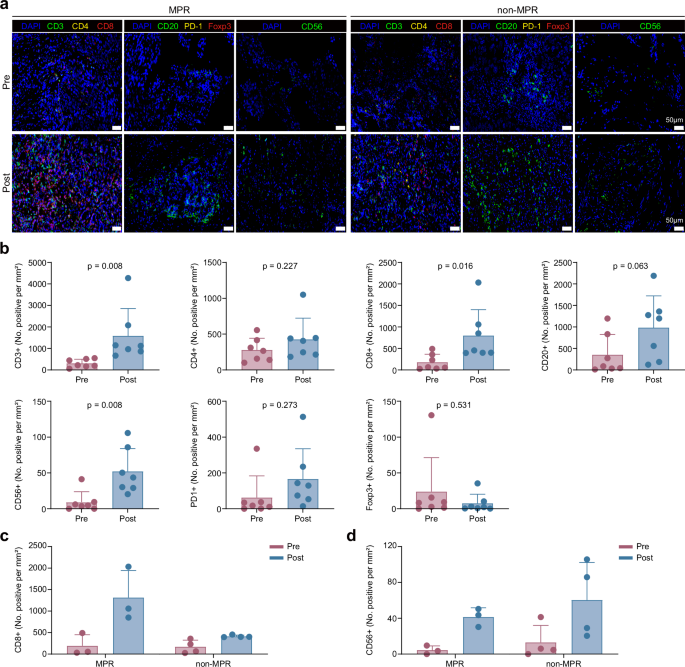 Fig. 2: Correlation of the tumor immune microenvironment response to neoadjuvant tislelizumab and afatinib.