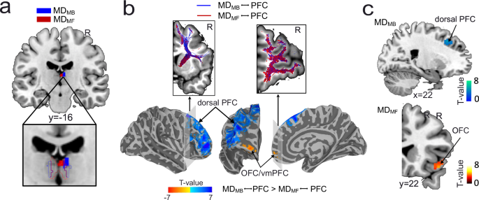 Fig. 5: The model-free (MF) and model-based (MB) related MD exhibit distinct anatomical and functional connectivity with PFC.