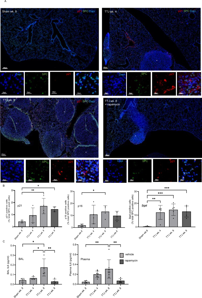 Fig. 4: Senescence and IL-6 secretion increase with time and disease burden.