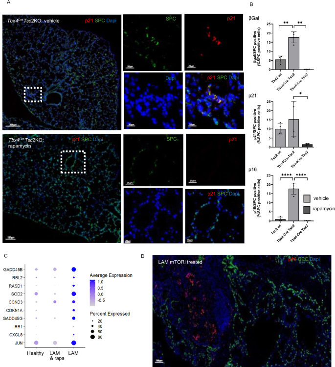 Fig. 5: AT2 cell senescence is mTOR dependent.