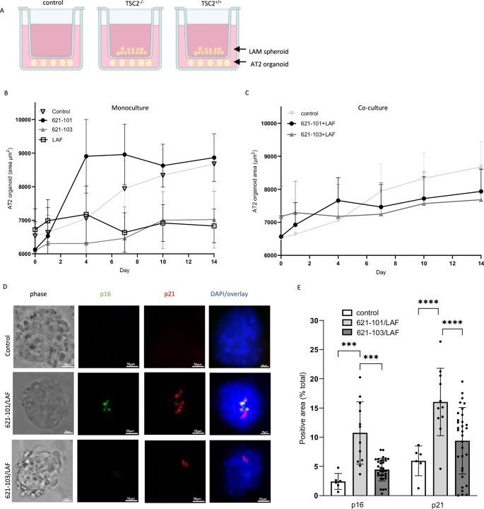 Fig. 7: LAM nodules induce AT2 cell senescence in vitro.