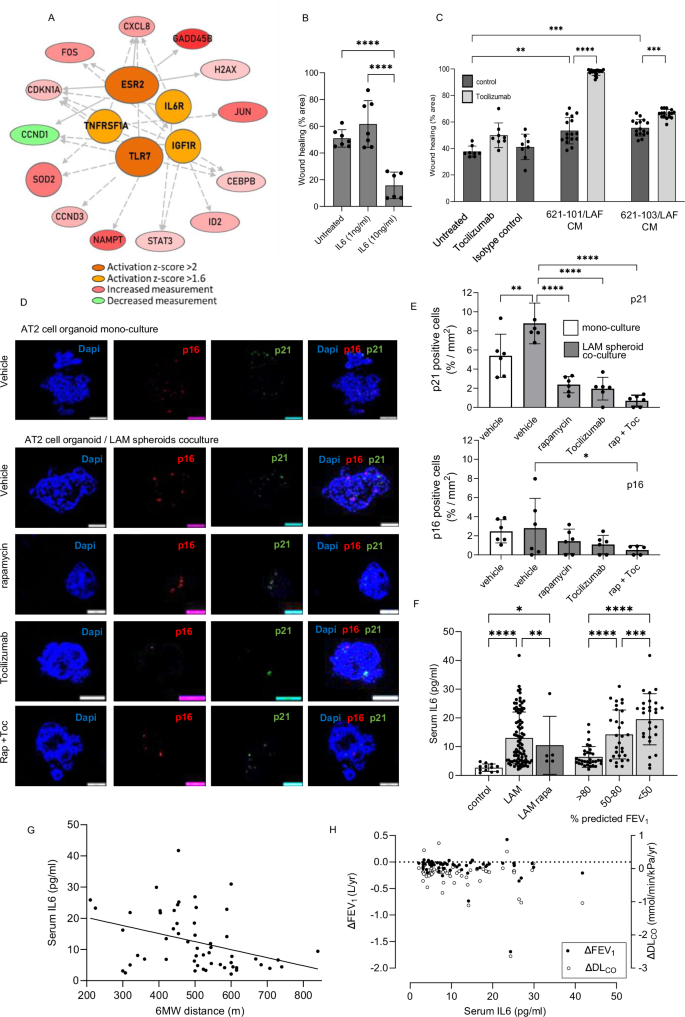 Fig. 8: IL-6 signalling induced by LAM nodules affects wound repair in vitro.