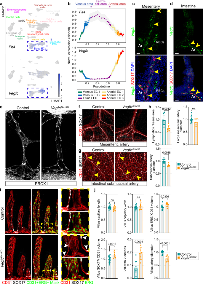 Esm1 Signalling Pathways Artery formation in the intestinal wall and mesentery by intestine ...