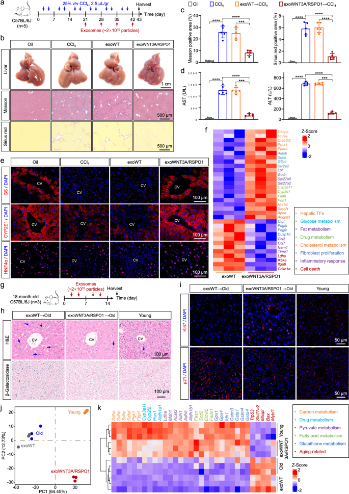 Fig. 6: exoWNT3A/RSPO1 repairs and restores liver function after chronic liver injury and in aging mouse liver.