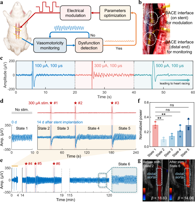 Fig. 4: Bidirectional modulation of vasomotor dysfunction.
