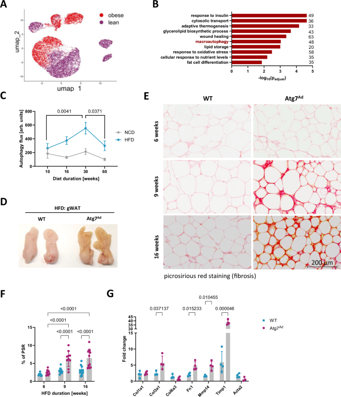 Fig. 1: Obesity dysregulates autophagy, which limits pericellular fibrosis in WAT.