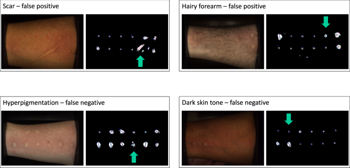 Fig. 2: Representative images of difficult cases for the AI algorithm measurement.