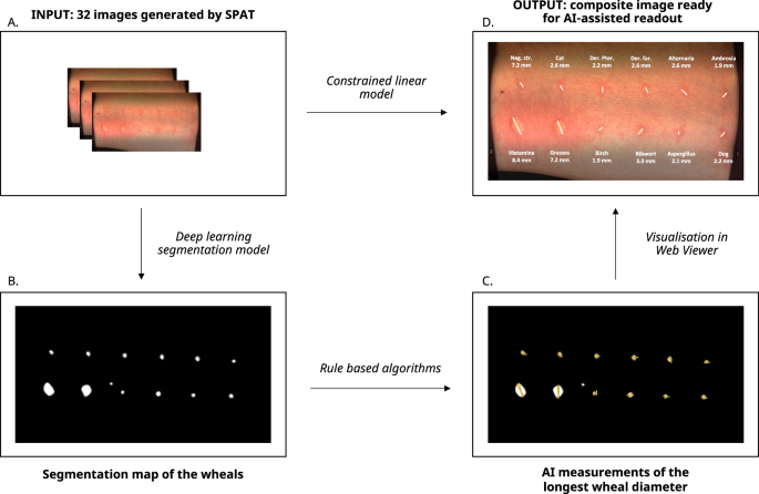 Fig. 5: Main processing steps of artificial intelligence (AI)-assisted readout software.