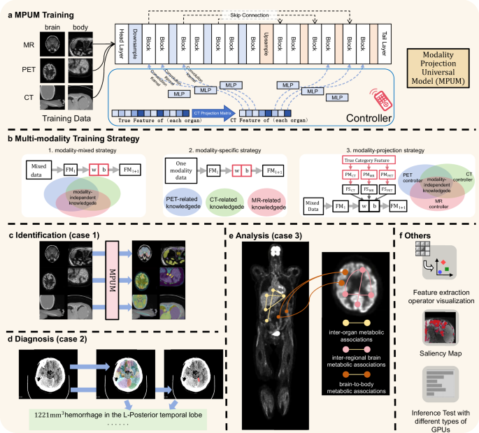 Modality-projection universal model for comprehensive full-body medical ...