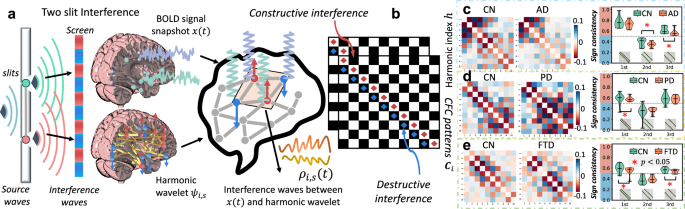 Fig. 2: From wave interference to CFC patterns: physics-inspired fingerprints for neurodegenerative diseases.