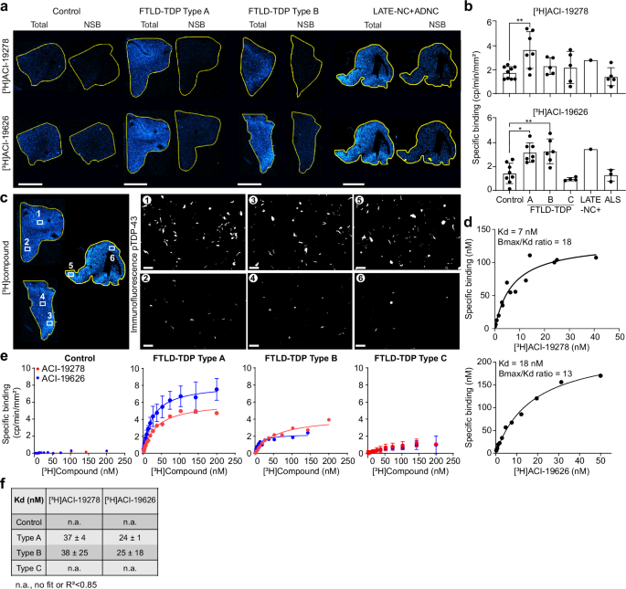 Fig. 1: Characterization of binding of [³H]ACI-19278 and [³H]ACI-19626 to brain samples from TDP-43 proteinopathies.